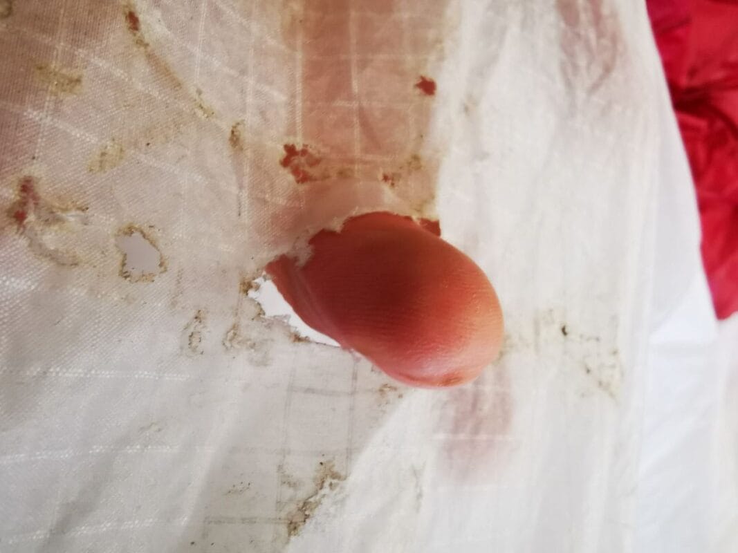 Gleitschirm beschädigt